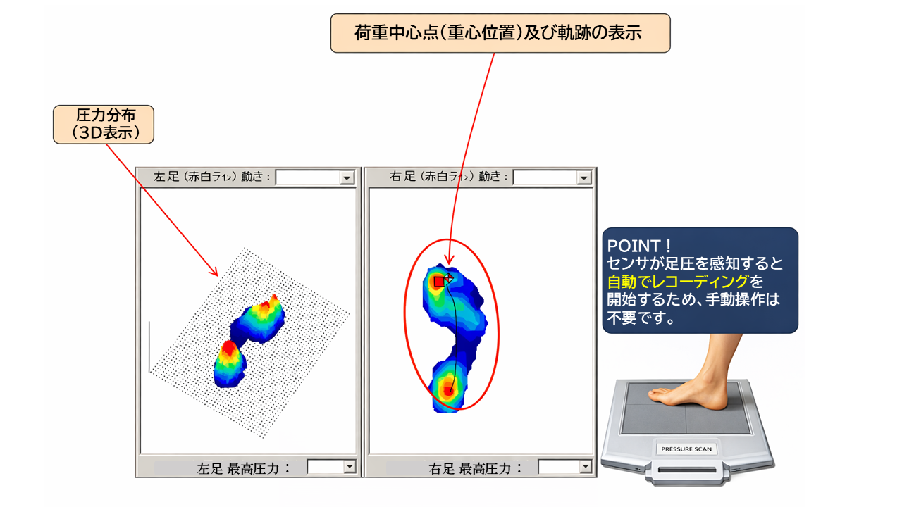 ウォーキング測定モードでは、歩行時の足圧分布と同時に、足圧重心とその軌跡の測定ができます。サンプリング速度は 40Hz です。 踵接地からつま先離地までの床反力を解析することが可能 です。足の機能、歩行や姿勢に関する問題の評価や分析に使用するための生体力 学的分析ツールとなります。例えば臨床医に対して症状に対する理解、治療前・治療中・治療後の分析・評価に役立ちます。 遊脚中期での測定では、 3 歩以上手前から目線を普段どおりにしてそのままセンサ部を踏むだけで測定できます。
